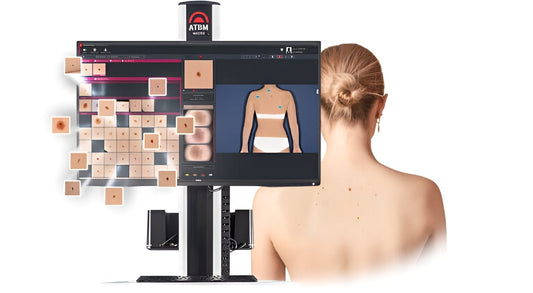 Why Mole Mapping Matters: Protect Your Skin with Expert Care in Cape Town