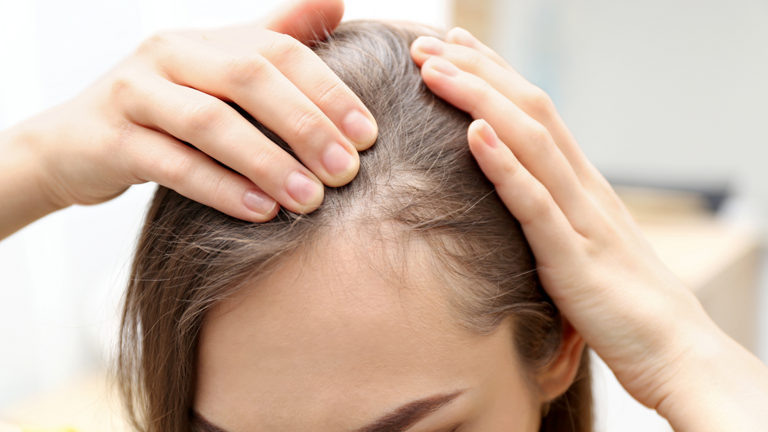 How Hormonal Imbalances Can Impact Hair Loss