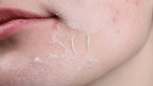 Dermatologist vs. Influencer Advice: How to Tell What’s Really Right for Your Skin